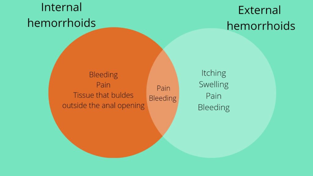 hemorroids symptoms