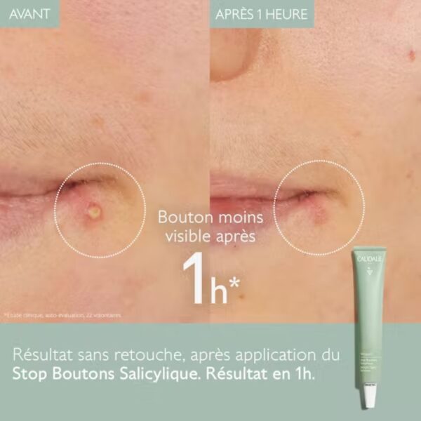 Caudalie Vinopure Stop Boutons Salicylique