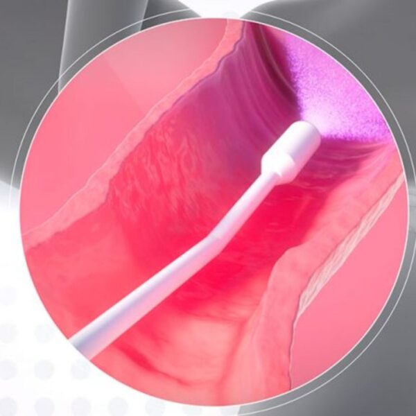 Colpofix Vaginal Spray Gel